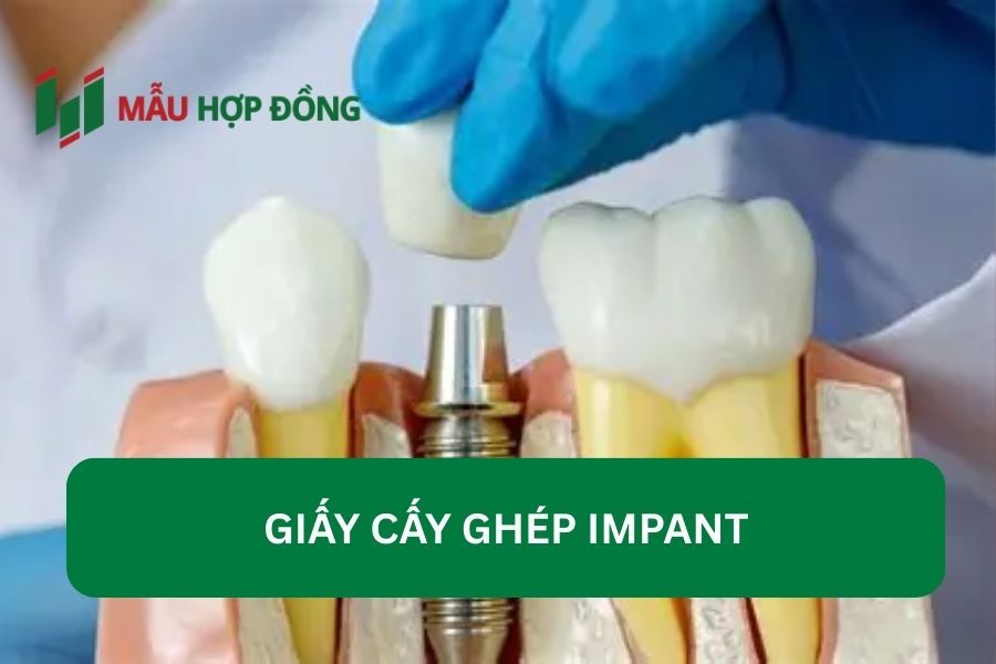 Quy định pháp luật liên quan đến cấy ghép Implant&nbsp;
